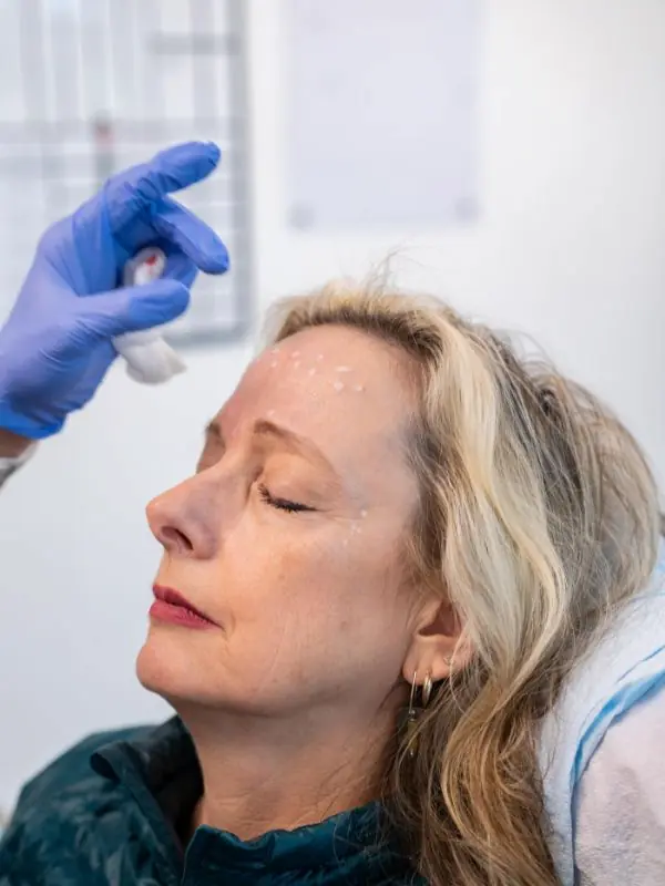 Botox-2