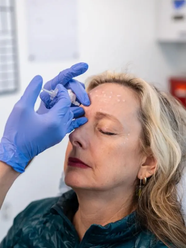 Botox-3