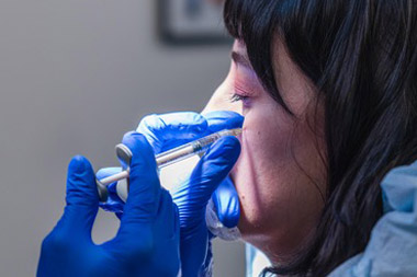 Mercer Island Cheek Filler