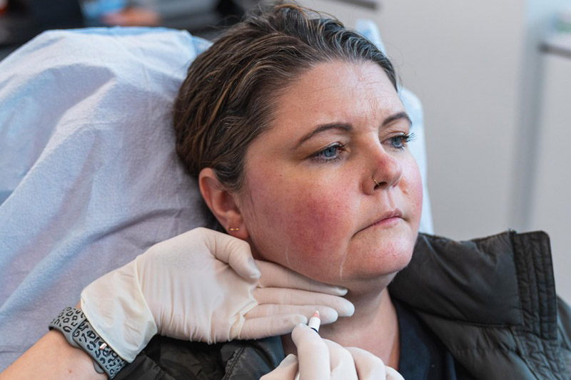 Mercer Island Jawline Filler