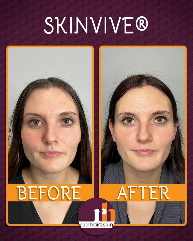 Skinvive B&A