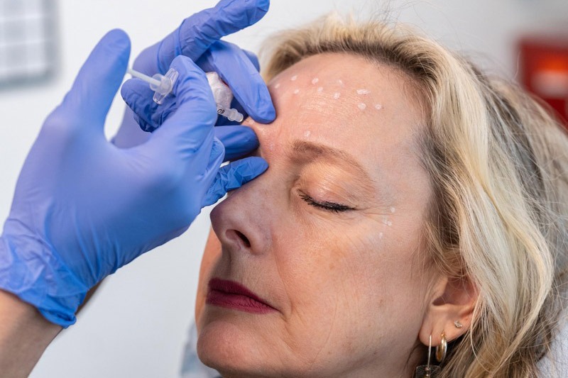 Newcastle Botox Injections