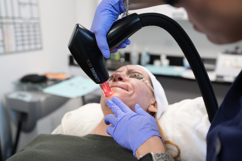 Newcastle Hyperpigmentation Treatment
