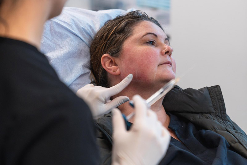 Issaquah Chin Filler