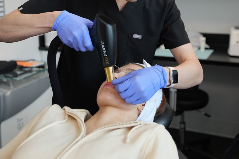Sammamish Skin Resurfacing